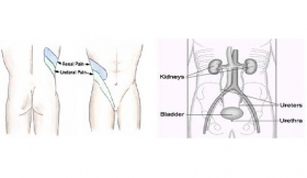 Ureteric Colic Treatment in Maharajganj