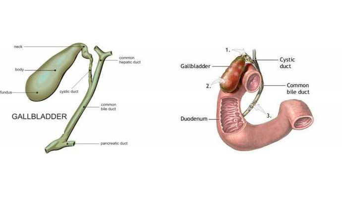 Gallbladder Gangrene Treatment in Amroha