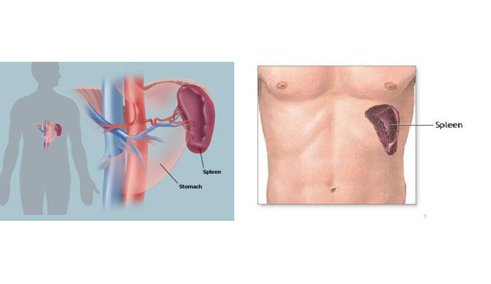 Splenic Rupture And Haemorrhage Treatment in Agra