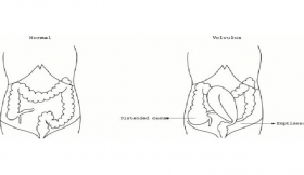 Gaseous Distension of The Abdomen Treatment in Gonda