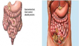 Gastrointestinal Perforation And Peritonitis Treatment in Gonda