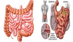 Intestines Operations Treatment in Harautha