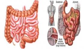 Intestines Operations Treatment in Bagpat