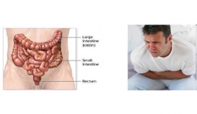 Loose Motions Diarrhoea Treatment in Jalaun