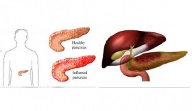 Pancreatitis Treatment in Saharanpur